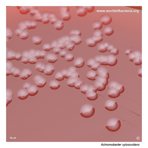 Small Achromobacter xylosoxidans colonies with a subtly uneven surface on blood agar