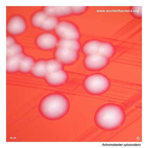 Close-up of grey-white non-haemolytic Achromobacter xylosoxidans colonies on blood agar