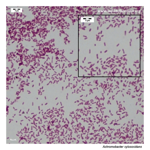 Gram-stained smear showing relatively small Gram-negative Achromobacter xylosoxidans rods