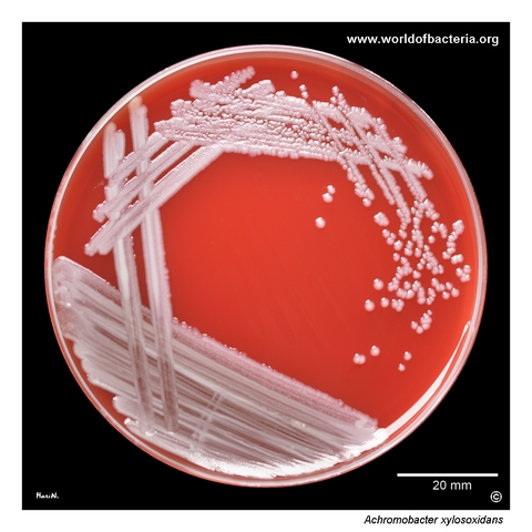 Achromobacter xylosoxidans isolated in significant quantity from an ear canal swab