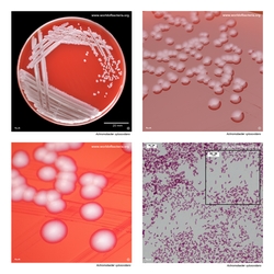 Composite laboratory image panel of Achromobacter xylosoxidans with preview photographs from the species overview page