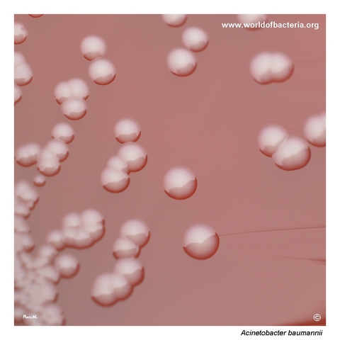 Smooth glistening grey-white Acinetobacter baumannii colonies on blood agar