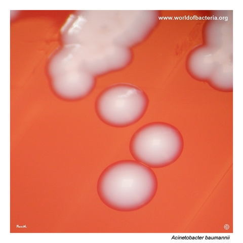 Close-up of non-haemolytic Acinetobacter baumannii colonies carrying OXA carbapenemase genes