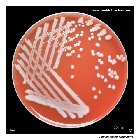 Acinetobacter baumannii isolate from an intensive-care patient with OXA-24-like and OXA-51-like carbapenemase genes