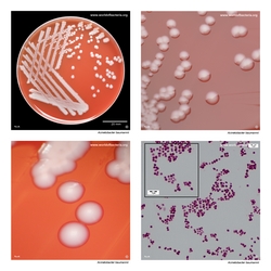 Composite laboratory image panel of Acinetobacter baumannii with preview photographs from the species overview page