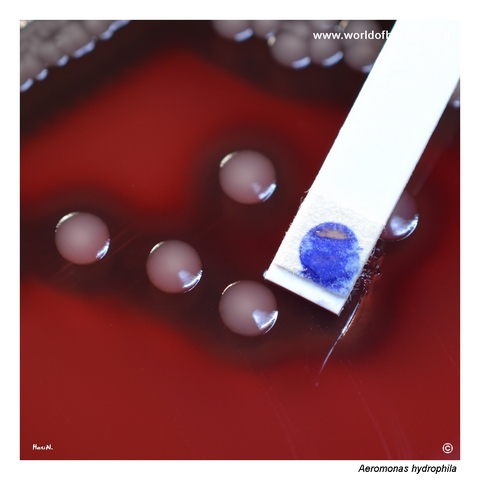 Close-up of smooth convex beta-haemolytic Aeromonas hydrophila colonies