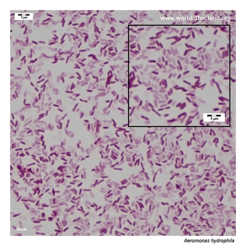Gram-negative Aeromonas hydrophila rods in a colony smear