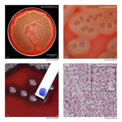 Composite laboratory image panel of Aeromonas hydrophila with preview photographs from the species overview page