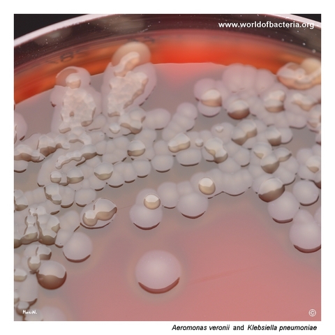 Aeromonas veronii and hypermucoid Klebsiella pneumoniae colonies on blood agar
