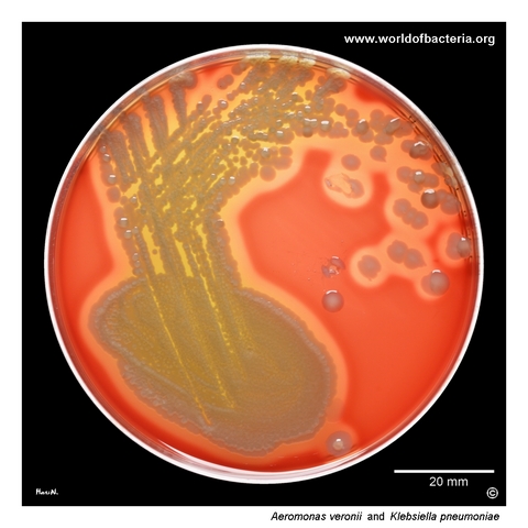 Mixed urine culture with beta-haemolytic Aeromonas veronii and non-haemolytic Klebsiella pneumoniae