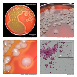 Composite laboratory image panel of Aeromonas veronii with preview photographs from the species overview page