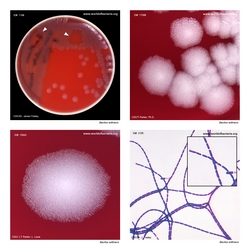 Composite laboratory image panel of Bacillus anthracis with preview photographs from the species overview page
