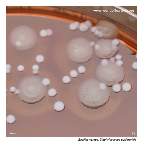 Large grey rough beta-haemolytic colonies of Bacillus cereus on blood agar beside white Staphylococcus epidermidis colonies
