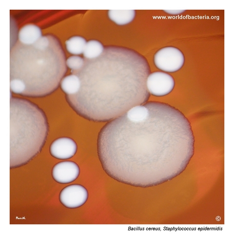 Close-up of Bacillus cereus and Staphylococcus epidermidis colonies highlighting the coarse matte surface of Bacillus cereus