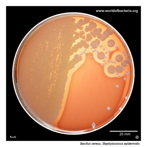Bacillus cereus and Staphylococcus epidermidis on blood agar with broad beta-haemolysis around Bacillus cereus colonies