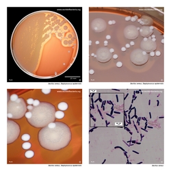 Composite laboratory image panel of Bacillus cereus with preview photographs from the species overview page