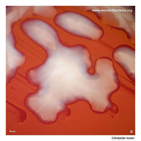 Strongly mucoid and highly glistening Citrobacter koseri colonies on blood agar