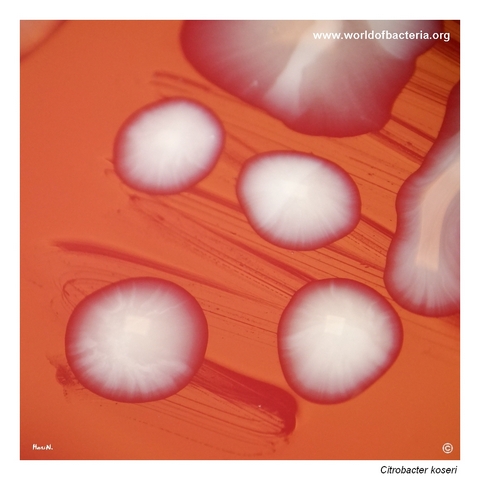 Close-up of large smooth convex strongly mucoid Citrobacter koseri colonies
