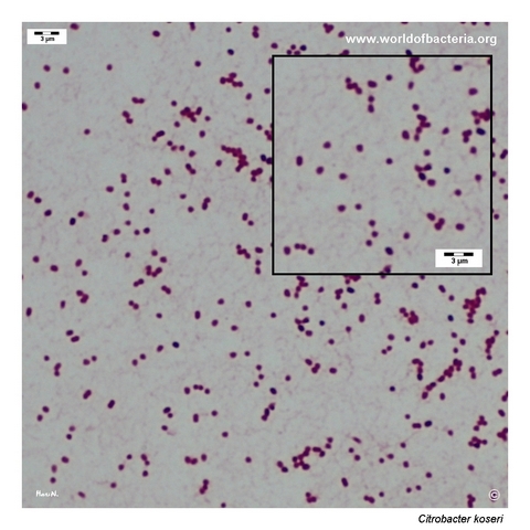 Very short Gram-negative Citrobacter koseri rods from a strongly mucoid colony