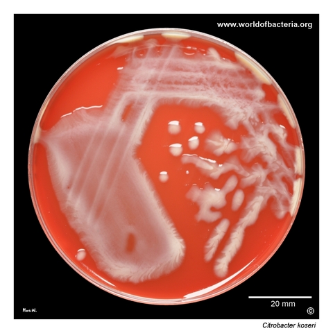 Strongly mucoid Citrobacter koseri urinary isolate growing on blood agar