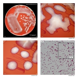 Composite laboratory image panel of Citrobacter koseri with preview photographs from the species overview page