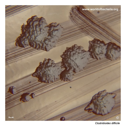 Irregular coarse matt colonies of Clostridioides difficile in reflected light