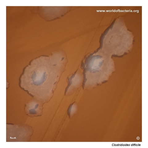 Close-up of a smoother colony variant of Clostridioides difficile on Schaedler agar
