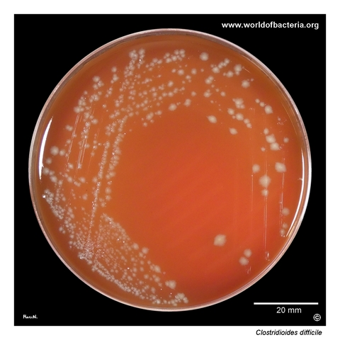 Clostridioides difficile on Schaedler agar showing irregular colonies after anaerobic incubation