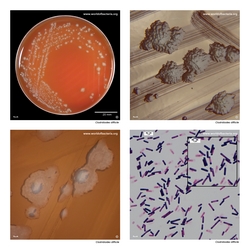 Composite laboratory image panel of Clostridioides difficile with preview photographs from the species overview page