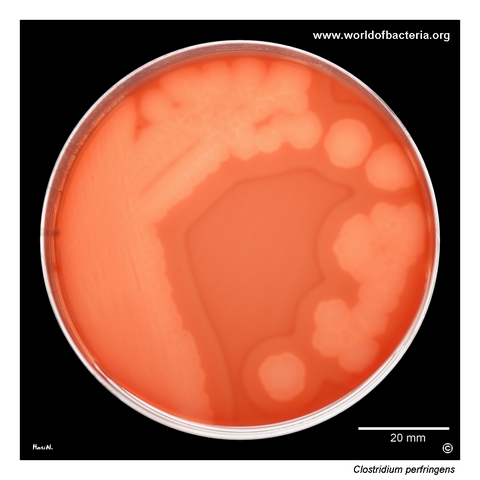 Clostridium perfringens on blood agar in transmitted light showing the characteristic double zone of haemolysis