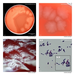 Composite laboratory image panel of Clostridium perfringens with preview photographs from the species overview page