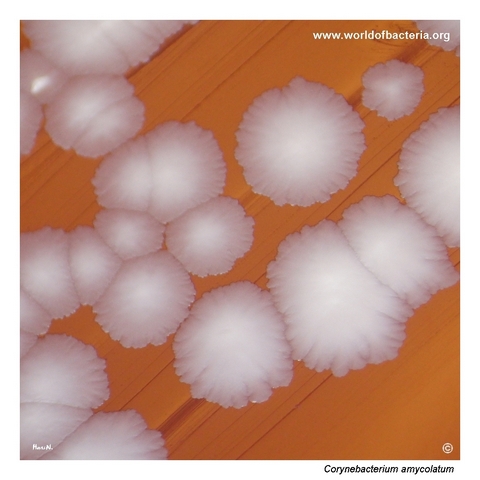Colonies of Corynebacterium amycolatum on blood agar with a lobate serrated outline