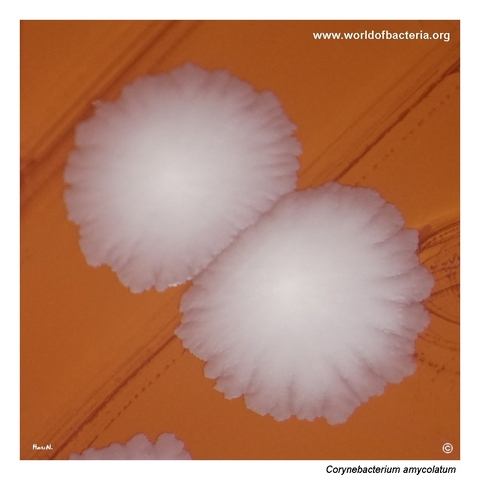 Close-up view of Corynebacterium amycolatum colonies on blood agar highlighting the irregular colony contour