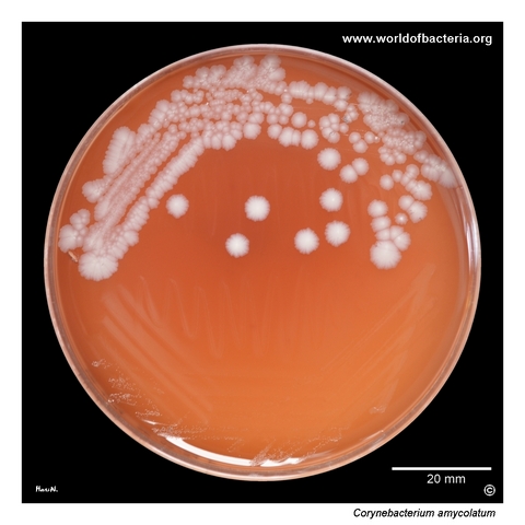 Corynebacterium amycolatum on blood agar from a polymicrobial diabetic wound culture