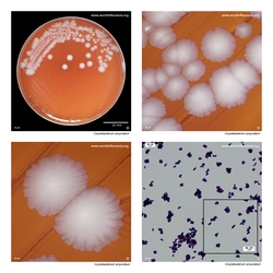 Composite laboratory image panel of Corynebacterium amycolatum with preview photographs from the species overview page