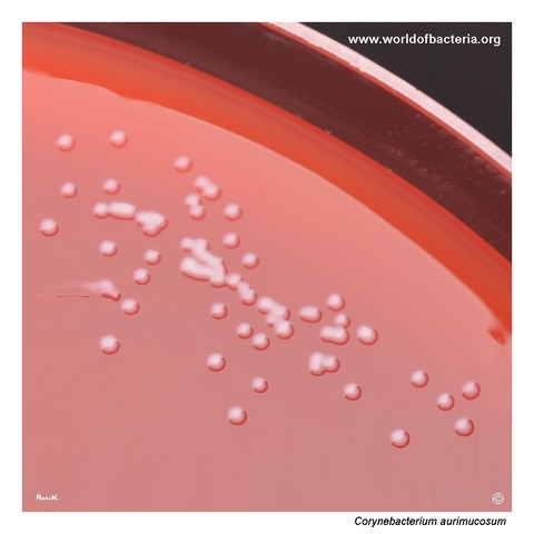 Small early colonies of Corynebacterium aurimucosum on blood agar after 24 hours