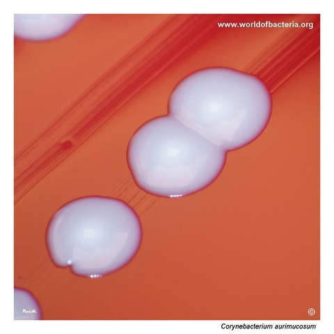Close-up view of Corynebacterium aurimucosum colonies after prolonged incubation with raised centre