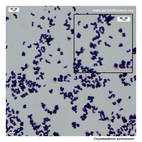 Gram-stained smear of Corynebacterium aurimucosum showing short Gram-positive coryneform rods