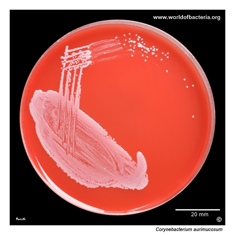 Corynebacterium aurimucosum in primary midstream urine culture on blood agar