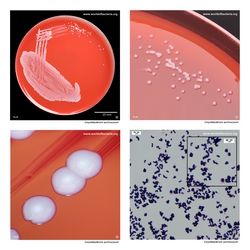 Composite laboratory image panel of Corynebacterium aurimucosum with preview photographs from the species overview page