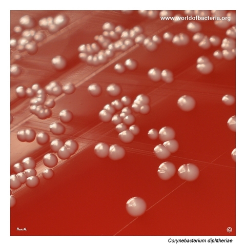 Colonies of Corynebacterium diphtheriae on blood agar
