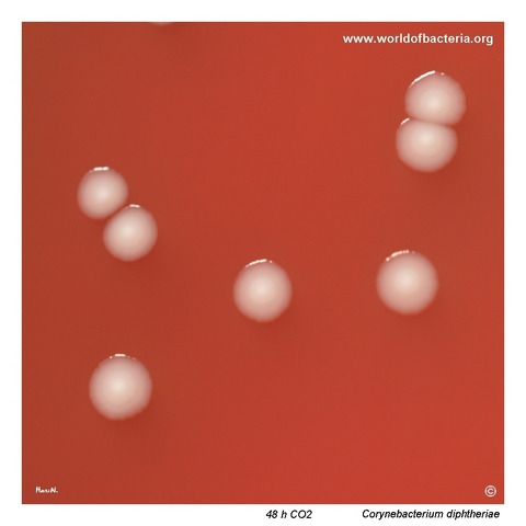 Close-up view of Corynebacterium diphtheriae colonies on blood agar