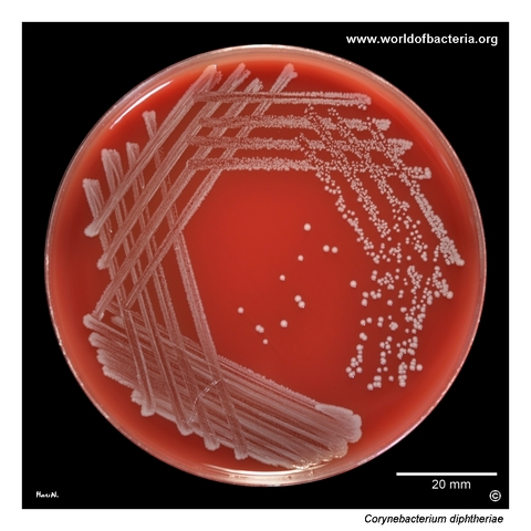 Corynebacterium diphtheriae on blood agar, non-toxigenic external quality assessment strain