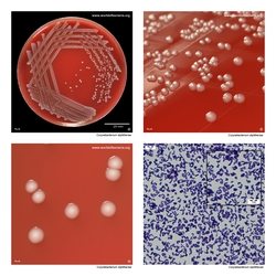 Composite laboratory image panel of Corynebacterium diphtheriae with preview photographs from the species overview page