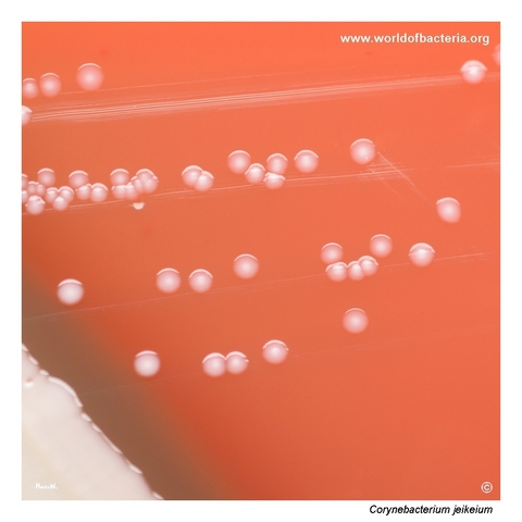 Corynebacterium jeikeium colonies near a streak of Staphylococcus aureus ATCC 25923 on blood agar