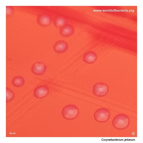 Close-up view of Corynebacterium jeikeium colonies on blood agar