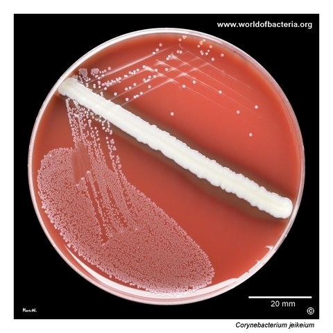 Blood agar culture of Corynebacterium jeikeium from a tissue fragment from the plantar surface of the foot