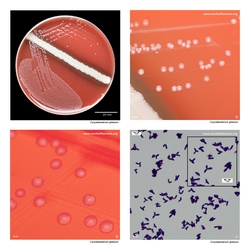 Composite laboratory image panel of Corynebacterium jeikeium with preview photographs from the species overview page