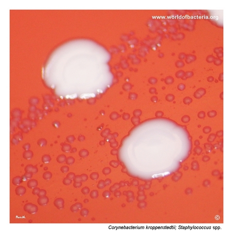 Very small non-haemolytic colonies of Corynebacterium kroppenstedtii near white colonies of Staphylococcus species on blood agar
