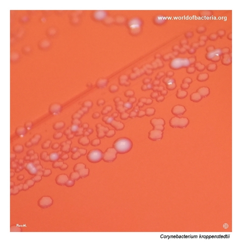 Close-up view of Corynebacterium kroppenstedtii colonies showing two colony types on blood agar